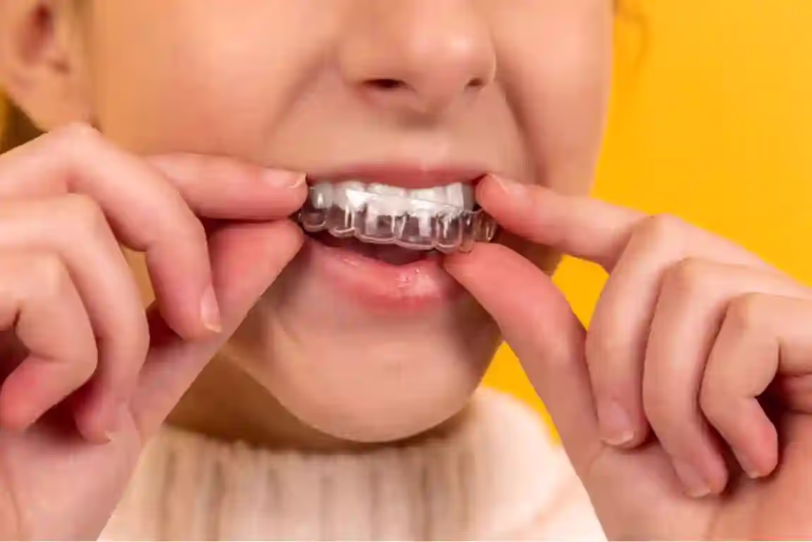 clearinvisalign.store